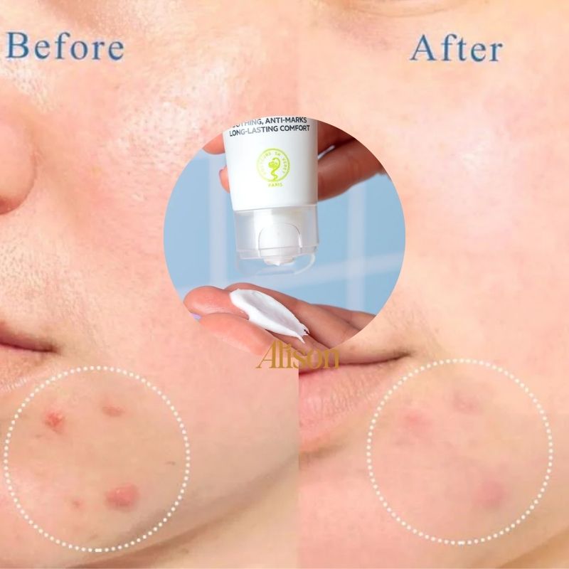 Kem Dưỡng Ẩm Cho Da Dầu SVR Sebiaclear Hydra